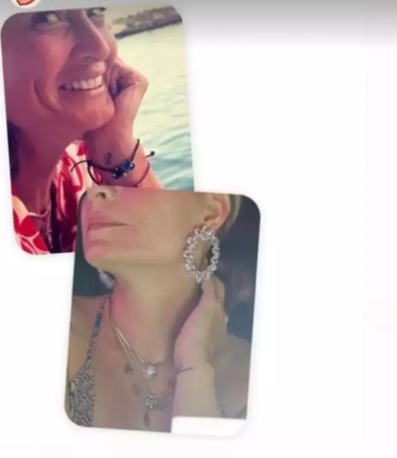 Eski eşinden kalan dövme izini yok etti!